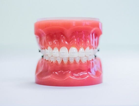 clovis nm braces