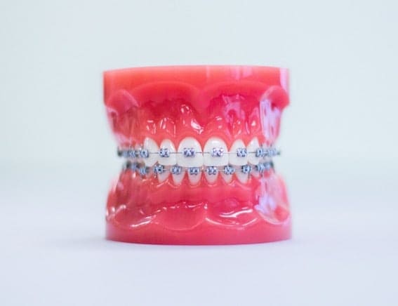 clovis nm braces