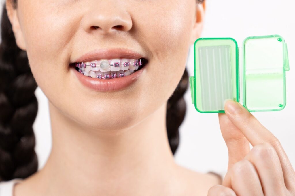 Lubbock orthodontics team helping patients choose Invisalign or braces